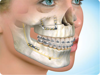 Dental And Maxillofacial Surgeon